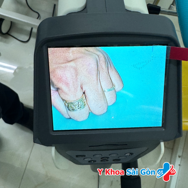 Máy soi cổ tử cung YKD-3003 có màn hình