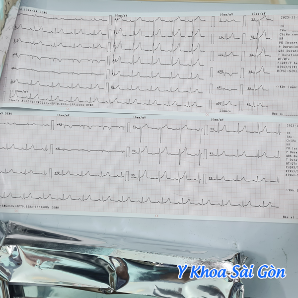 GIẤY ĐO ĐIỆN TIM