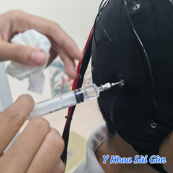Bơm gel đo điện não