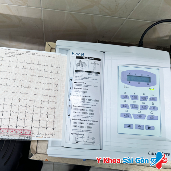 GIẤY ĐIỆN TIM 12 KÊNH