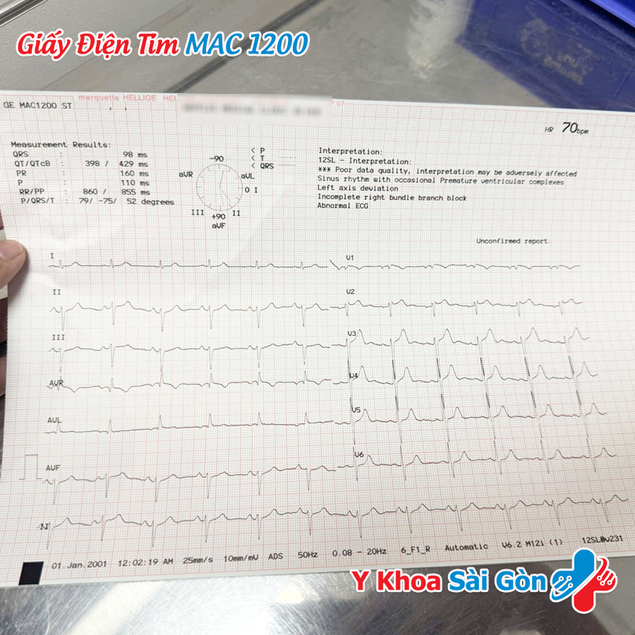 giấy in điện tim GE 210×295mm